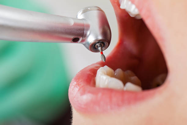 Tooth Infection Emergency Dentist in MS